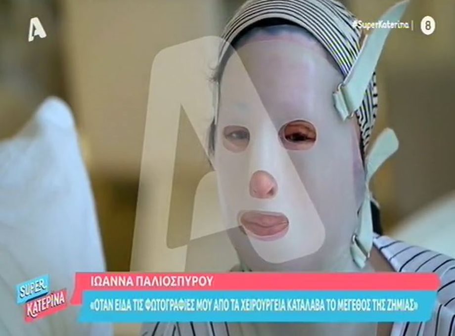 Ιωάννα Παλιοσπύρου: Η πρώτη συγκλονιστική τηλεοπτική συνέντευξη μετά την επίθεση με το βιτριόλι