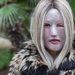 Ιωάννα Παλιοσπύρου: “Το κορίτσι με τη μάσκα” και τη δύναμη ψυχής - Το χρονικό της ιστορίας με το βιτριόλι