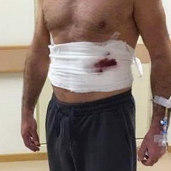Πασίγνωστος Έλληνας ηθοποιός τραυματισμένος στο νοσοκομείο: Τι συνέβη;