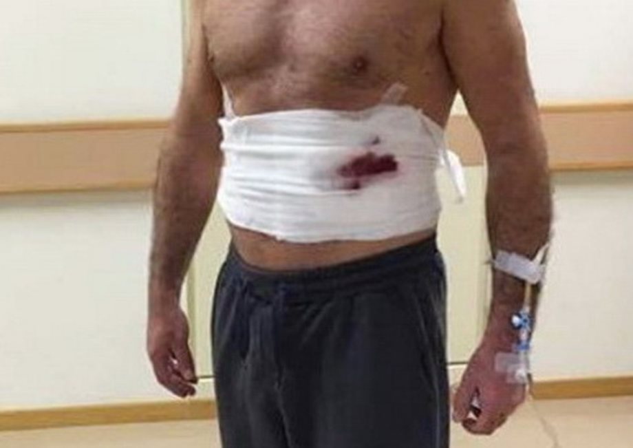 Πασίγνωστος Έλληνας ηθοποιός τραυματισμένος στο νοσοκομείο: Τι συνέβη;