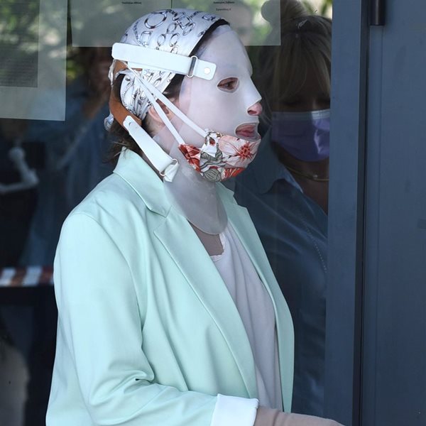 Ιωάννα Παλιοσπύρου: Δημοσίευσε πρώτη φορά φωτογραφία με το τραύμα της μετά την χειρουργική επέμβαση που υποβλήθηκε 