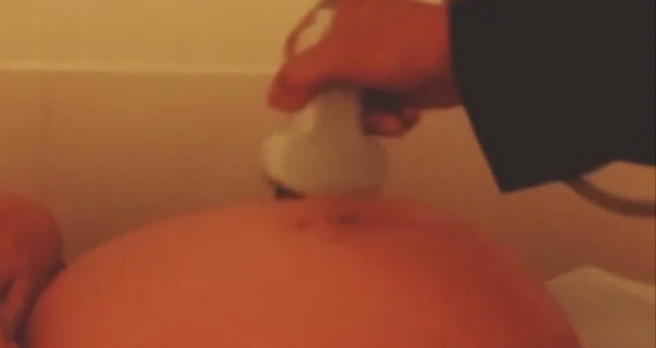 Η εγκυμονούσα σύζυγός του έκανε υπέρηχο κι εκείνος δημοσίευσε το VIDEO στο Instagram