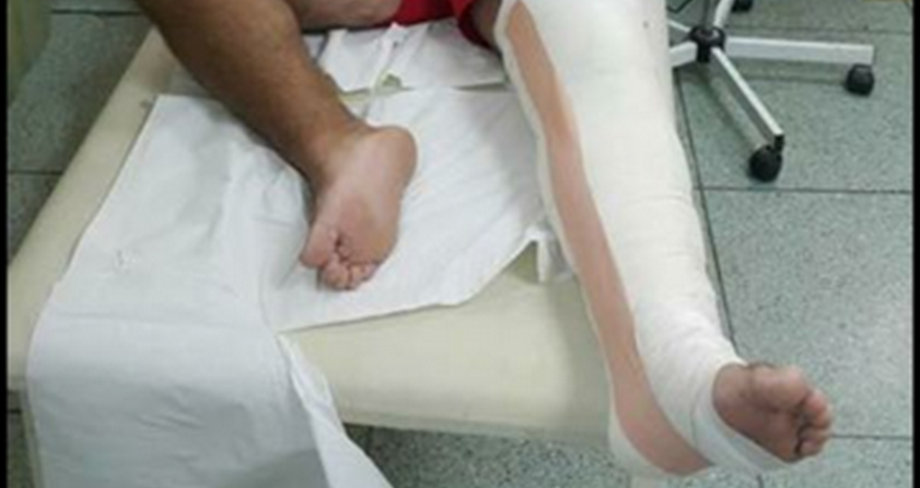 Ο νιόπαντρος Έλληνας celebrity, έσπασε το πόδι του λίγες μέρες μετά το γάμο!