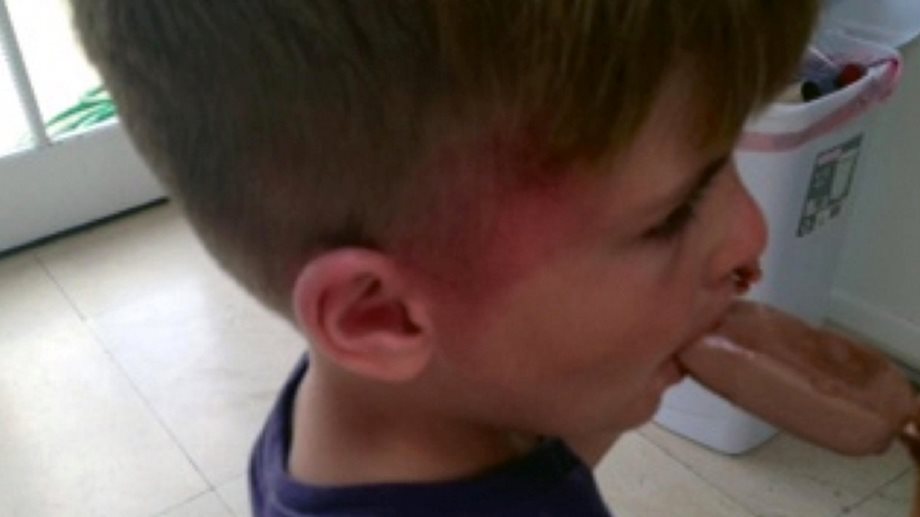 Σοκ! Ο 4χρονος γιος του Charlie Sheen με τραύματα στο κεφάλι. Κατηγορούν την ναρκομανή μητέρα του