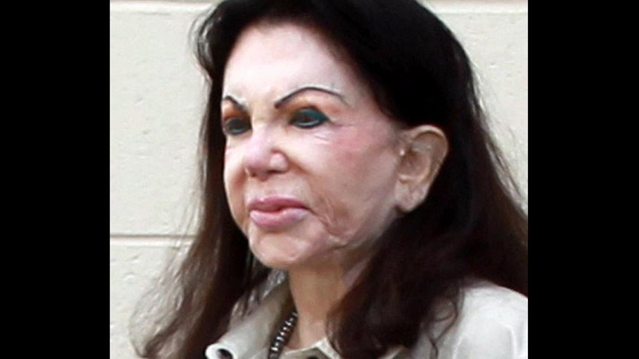 Πώς συντηρεί η μητέρα του Sylvester Stallone το πρόσωπό της για να μην λιώσει μετά από τόσες πλαστικές;
